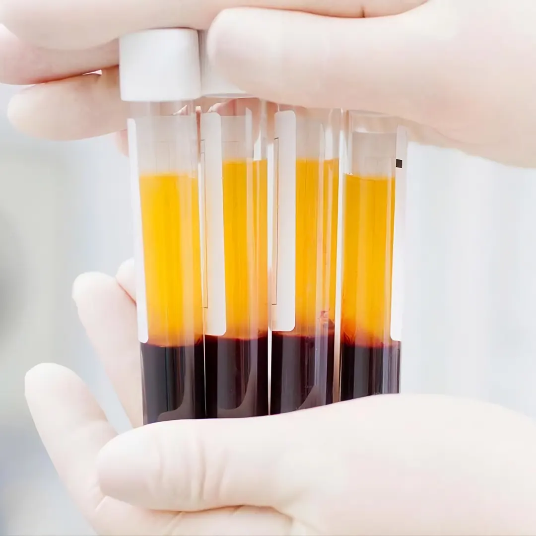 muestras de sangre en tubos de ensayo